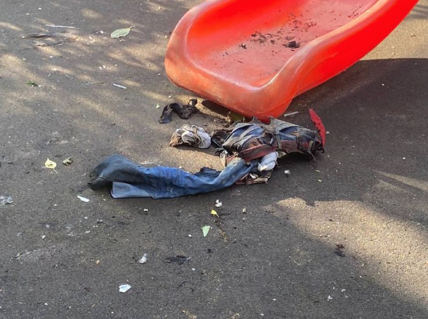 В Москве скончался мальчик, которого приятель поджег на детской площадке